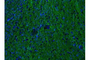 Indirect immunostaining of PFA-fixed mouse brain section (dilution 1 : 500; green). (alpha Tubulin antibody  (AA 419-435))