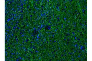 Indirect immunostaining of PFA-fixed mouse brain section (dilution 1 : 500; green). (alpha Tubulin antibody  (AA 419-435))