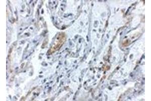 Immunohistochemistry of TNFAIP3 in human lung tissue with this product at 5 μg/ml. (TNFAIP3 antibody  (Center))