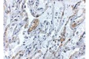 Immunohistochemistry of TNFAIP3 in human lung tissue with this product at 5 μg/ml. (TNFAIP3 antibody  (Center))