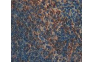 Used in DAB staining on fromalin fixed paraffin- embedded Kidney tissue (CD93 antibody  (AA 427-644))