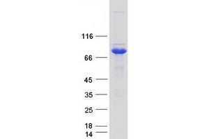 Validation with Western Blot (HSD17B4 Protein (Myc-DYKDDDDK Tag))