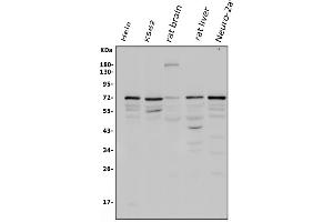 Western blot analysis of POT1 using anti-POT1 antibody (ABIN3043444). (POT1 antibody  (N-Term))