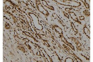 ABIN6277733 at 1/100 staining Human kidney tissue by IHC-P. (RAD21 antibody  (C-Term))