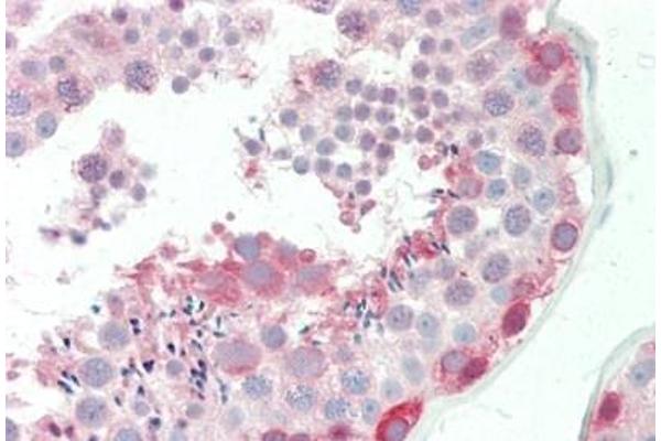 BAT3 antibody  (AA 943-992)