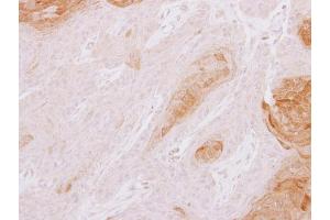 IHC-P Image TXNDC3 antibody [N3C3] detects TXNDC3 protein at cytoplasm on Cal27 xenograft by immunohistochemical analysis. (TXNDC3/NME8 antibody  (Center))