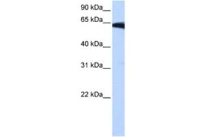 Western Blotting (WB) image for anti-Phosphatidylinositol Glycan W (PIGW) antibody (ABIN2463266)