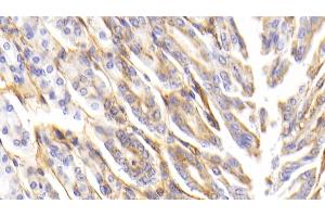 Detection of PIIINP in Mouse Stomach Tissue using Polyclonal Antibody to Procollagen III N-Terminal Propeptide (PIIINP)