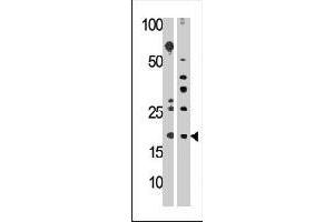 Western blot analysis of RPL23A polyclonal antibody  in HepG2 (left) and mouse liver (right) cell line lysates (35 ug/lane). (RPL23A antibody  (Internal Region))