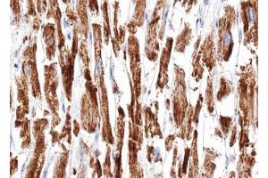 ABIN6266951 at 1/100 staining human Heart muscle tissue sections by IHC-P. (DOK7 antibody  (C-Term))