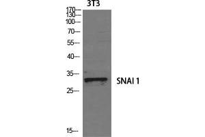 Western Blotting (WB) image for anti-SNAIL (SNAI1) (Ser246) antibody (ABIN5961917) (SNAIL antibody  (Ser246))