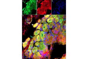 Expression of GsMTx-4-ATTO Fluor-647N in Rat DRG Frozen Sections. (GsMTx-4 peptide (Atto 647N))