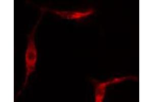 ABIN6267332 staining Hela cells by IF/ICC. (Ret Proto-Oncogene antibody  (pTyr1062))