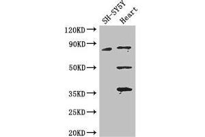 Western Blot Positive WB detected in: SH-SY5Y whole cell lysate, Mouse heart tissue All lanes: MAPT antibody at 3. (MAPT antibody  (AA 33-166))