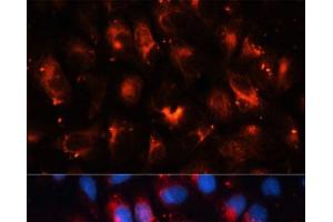 Immunofluorescence analysis of U-2OS cells using RALA Polyclonal Antibody at dilution of 1:100. (rala antibody)