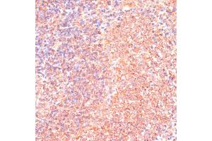 Immunohistochemistry of paraffin-embedded rat spleen using IL4R antibody (ABIN7268001) at dilution of 1:100 (40x lens). (IL4 Receptor antibody  (AA 26-232))