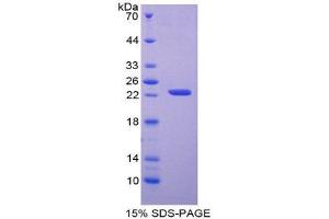SDS-PAGE (SDS) image for Adenine Phosphoribosyltransferase (APRT) (AA 1-180) protein (His tag) (ABIN2123914)