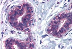 Immunohistochemical staining of human breast, lobular epithelium with CELSR2 polyclonal antibody . (CELSR2 antibody  (N-Term))