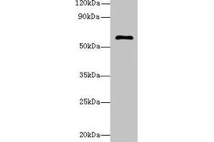 Western blot All lanes: GK5 antibody at 4 μg/mL + K562 whole cell lysate Secondary Goat polyclonal to rabbit IgG at 1/10000 dilution Predicted band size: 60, 34, 28 kDa Observed band size: 60 kDa (GK5 antibody  (AA 96-301))