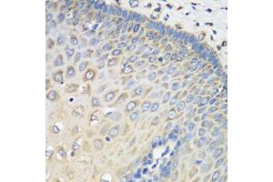Immunohistochemistry (Paraffin-embedded Sections) (IHC (p)) image for anti-Eukaryotic Translation Elongation Factor 1 gamma (EEF1G) (AA 168-437) antibody (ABIN6139951)