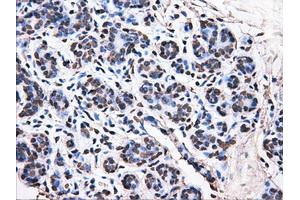Immunohistochemical staining of paraffin-embedded breast tissue using anti-ATP5B mouse monoclonal antibody. (ATP5B antibody)