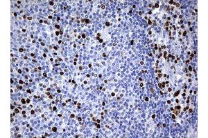 Image no. 2 for anti-Antigen Identified By Monoclonal Antibody Ki-67 (MKI67) (AA 1160-1493) antibody (ABIN1490859)