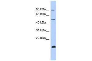 Human MCF-7; WB Suggested Anti-ZNF645 Antibody Titration: 0. (ZNF645 antibody  (Middle Region))