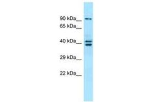 Image no. 1 for anti-L(3)mbt-Like 3 (L3MBTL3) (N-Term) antibody (ABIN6744892) (L3MBTL3 antibody  (N-Term))