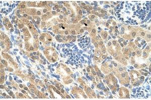 Human kidney (Indian Hedgehog antibody  (N-Term))