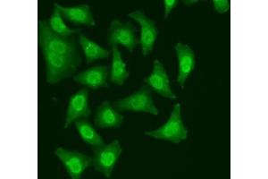 Immunofluorescence analysis of A549 cells using CDC5L antibody. (CDC5L antibody  (AA 563-802))