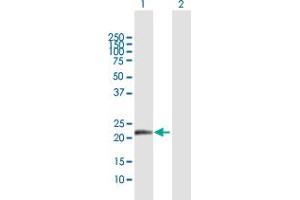 Western Blot analysis of NDUFB10 expression in transfected 293T cell line by NDUFB10 MaxPab polyclonal antibody. (NDUFB10 antibody  (AA 1-172))