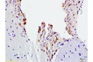 Formalin-fixed and paraffin embedded rat brain tissue labeled with Anti-ADRB2 Polyclonal Antibody, Unconjugated  at 1:200, followed by conjugation to the secondary antibody and DAB staining (beta 2 Adrenergic Receptor antibody  (AA 201-300))