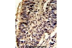 Immunohistochemistry (IHC) image for anti-Small Nuclear Ribonucleoprotein D2 Polypeptide 16.5kDa (SNRPD2) antibody (ABIN3002828) (SNRPD2 antibody)
