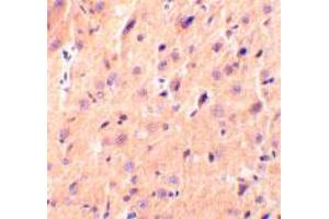 Immunohistochemical staining of rat brain tissue using CBLN1 polyclonal antibody  at 2 ug/mL . (CBLN1 antibody  (Internal Region))