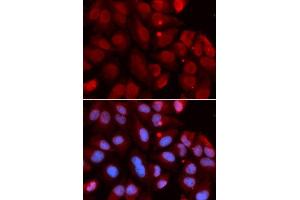 Immunofluorescence analysis of U2OS cells using RAG2 antibody. (RAG2 antibody  (AA 258-527))