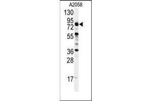 Western blot analysis of anti-COG4 Antibody (C-term) in A2058 cell line lysates (35ug/lane). (COG4 antibody  (C-Term))