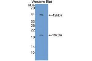Western blot analysis of recombinant Mouse IL1R1. (IL1R1 antibody  (AA 20-338))