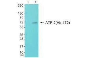 Western blot analysis of extracts from JK cells (Lane 2), using ATF-2 (Ab-472) antiobdy. (ATF2 antibody  (Ser472))