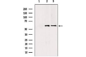 Western blot analysis of extracts from various samples, using PKLR antibody. (PKLR antibody  (Internal Region))