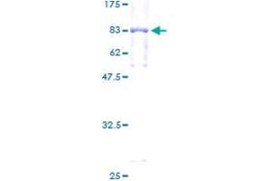 GBA Protein (AA 1-536) (GST tag)