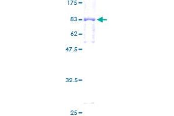 GBA Protein (AA 1-536) (GST tag)