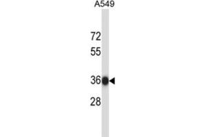 Western Blotting (WB) image for anti-N-Ethylmaleimide Sensitive Fusion Protein Attachment Protein beta (NAPB) antibody (ABIN2997844) (NAPB antibody)