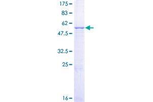 MMS19 Protein (AA 1-293) (GST tag)