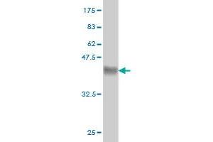 Western Blot detection against Immunogen (36. (ARMC8 antibody  (AA 287-385))