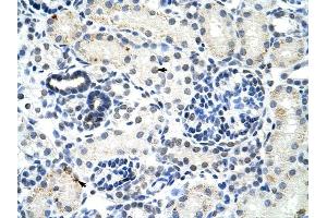 DDX17 antibody was used for immunohistochemistry at a concentration of 4-8 ug/ml to stain Epithelial cells of renal tubule (arrows) in Human Kidney. (DDX17 antibody)