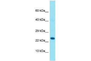 Western Blotting (WB) image for anti-GRB2-Related Adaptor Protein (GRAP) (N-Term) antibody (ABIN2791566) (GRAP antibody  (N-Term))