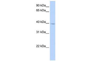 IQCD antibody used at 1 ug/ml to detect target protein. (IQCD antibody  (N-Term))