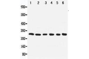 Anti-Apoptosis repressor with CARD antibody, Western blotting Lane 1: SMMC Cell Lysate Lane 2: A549 Cell Lysate Lane 3: U87 Cell Lysate Lane 4: HELA Cell Lysate Lane 5: MCF-7 Cell Lysate Lane 6: Rat Liver Tissue Lysate (NOL3 antibody  (Middle Region))