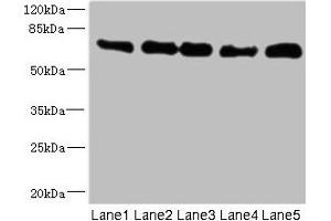 Western blot All lanes: NUMB antibody at 0. (NUMB antibody  (AA 532-651))