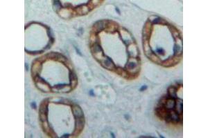 Used in DAB staining on fromalin fixed paraffin-embedded Kidney tissue (PVRL2 antibody  (AA 76-353))